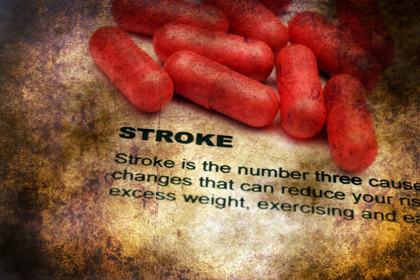Stroke and oral health