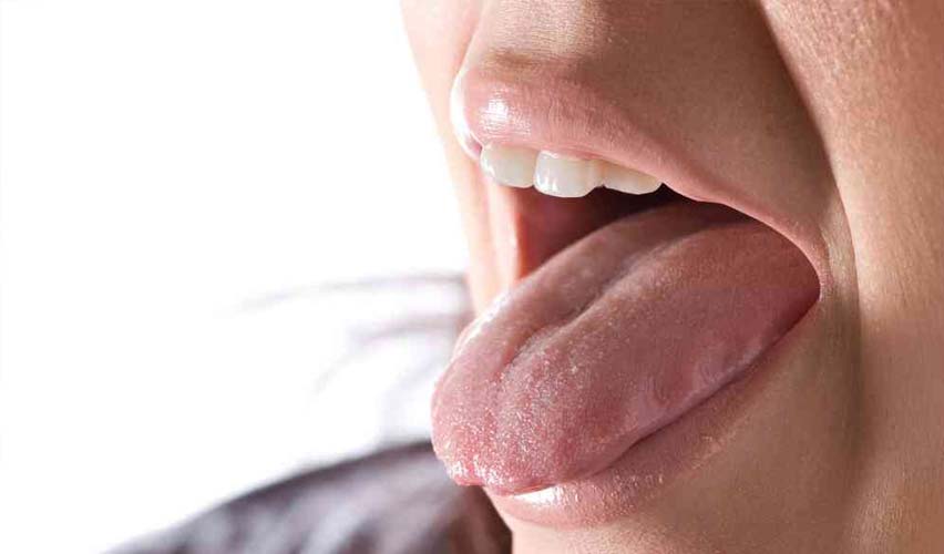 Burning Mouth Syndrome and Oral Health